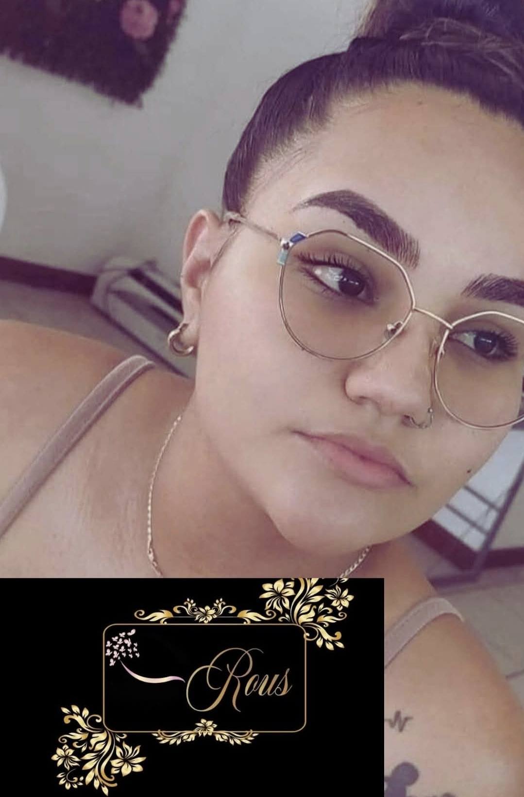 Brow correction before and after