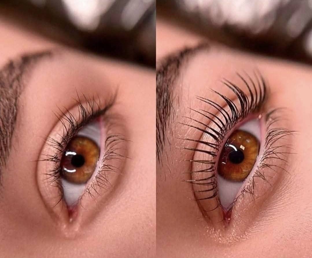 Dermapen rejuvenation