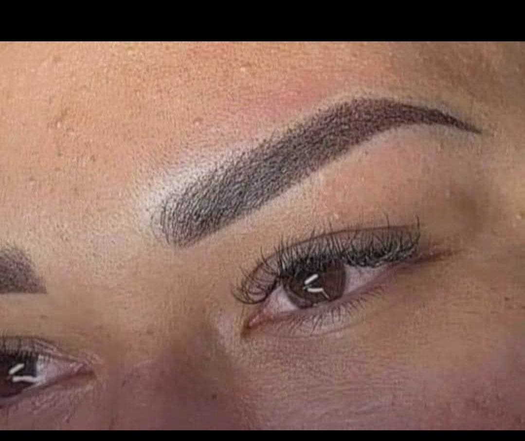 Plasmage tightening outcome