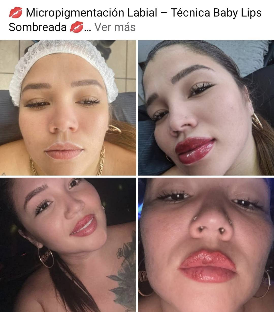 Lip micropigmentation shading